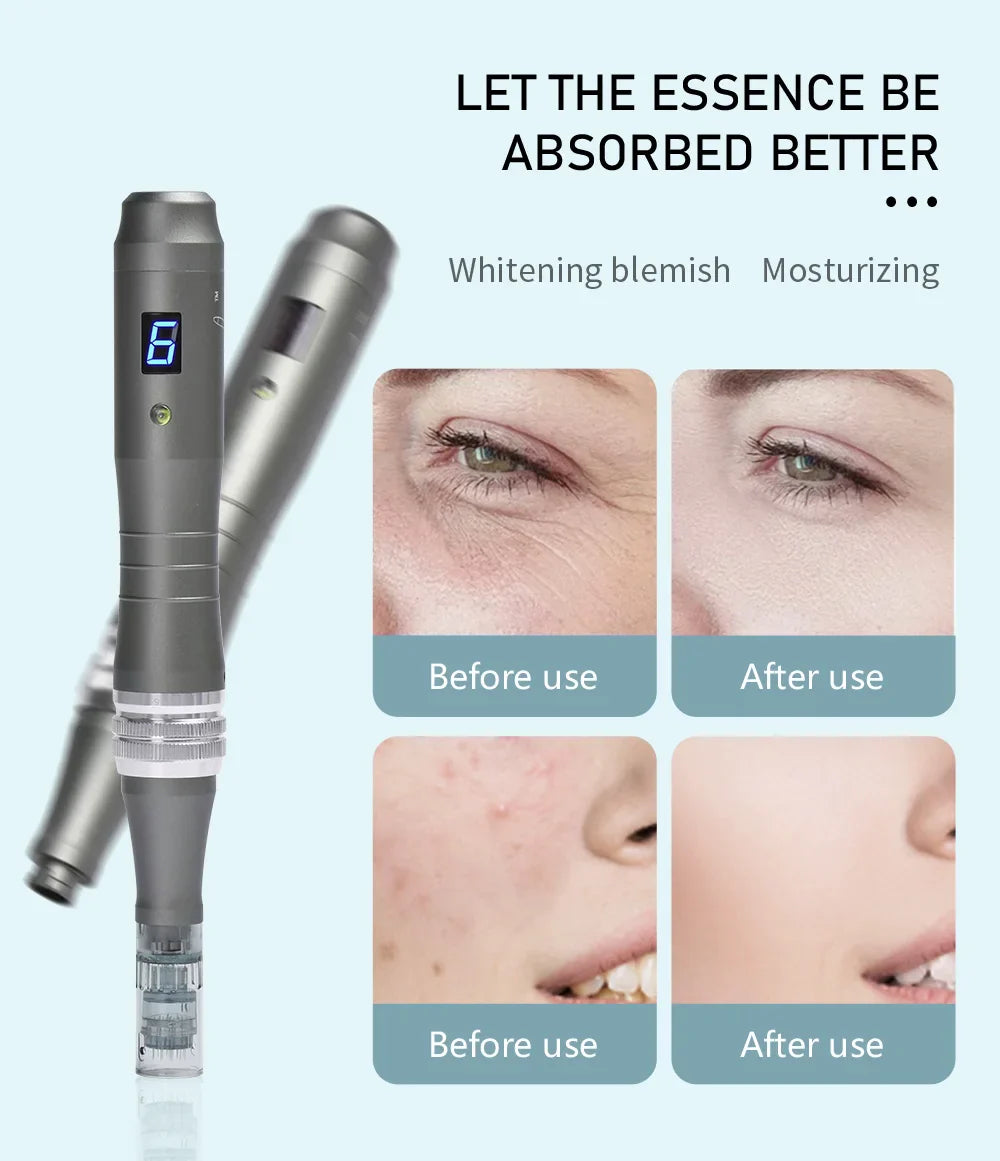 Dr Pen- Ultimate Microneedling Pen