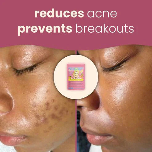 Turmeric & Kojic Acid Cleansing Pads