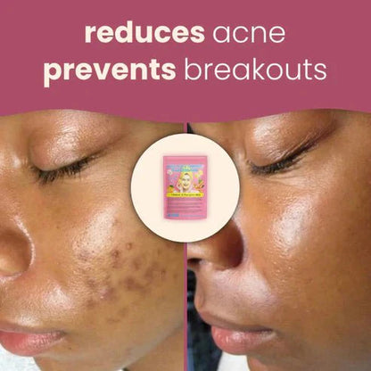 Turmeric & Kojic Acid Cleansing Pads