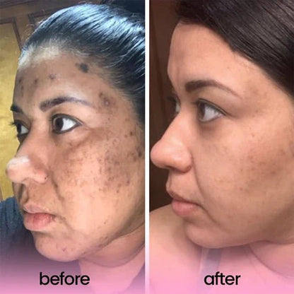 Turmeric & Kojic Acid Cleansing Pads