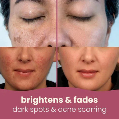 Turmeric & Kojic Acid Cleansing Pads