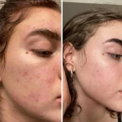 Turmeric & Kojic Acid Cleansing Pads